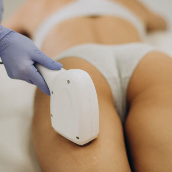 Inner Thigh Cryo-lipolysis Fat Freezing